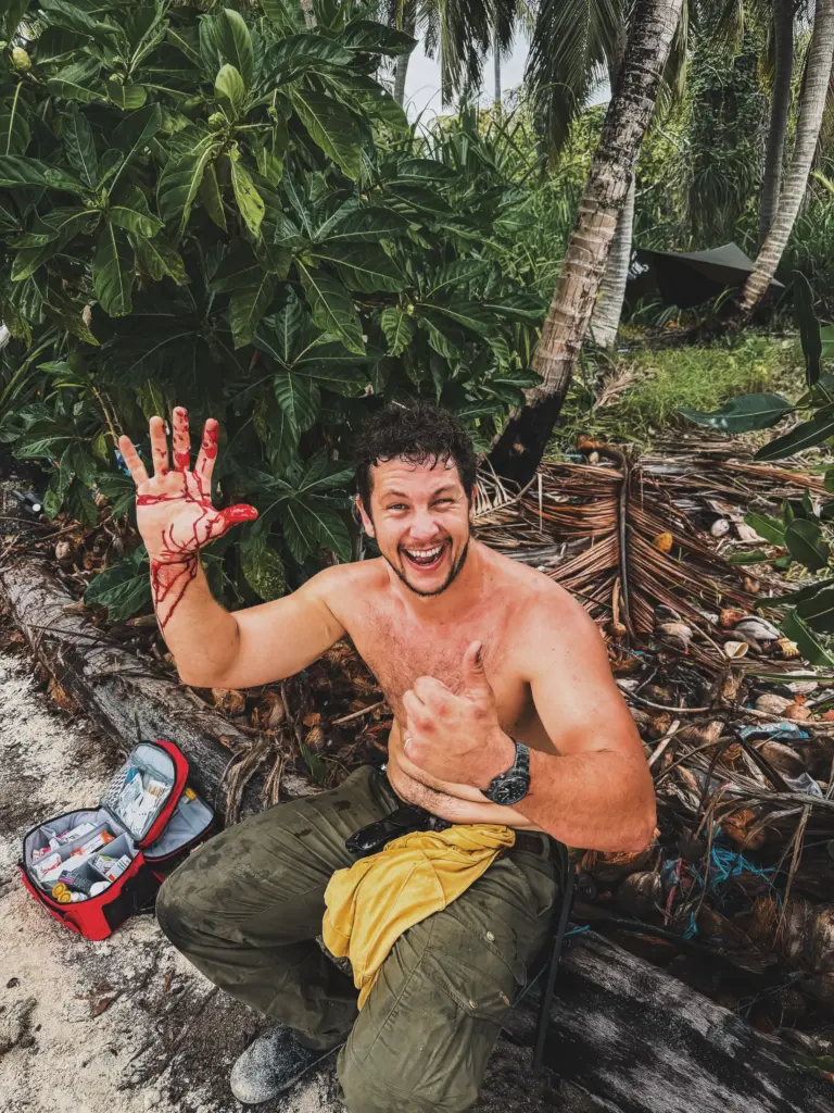 Survival training: Man with bloody hand gives thumbs up, first aid kit nearby.